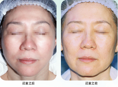 威客电竞(vkgame)-为竞技而生