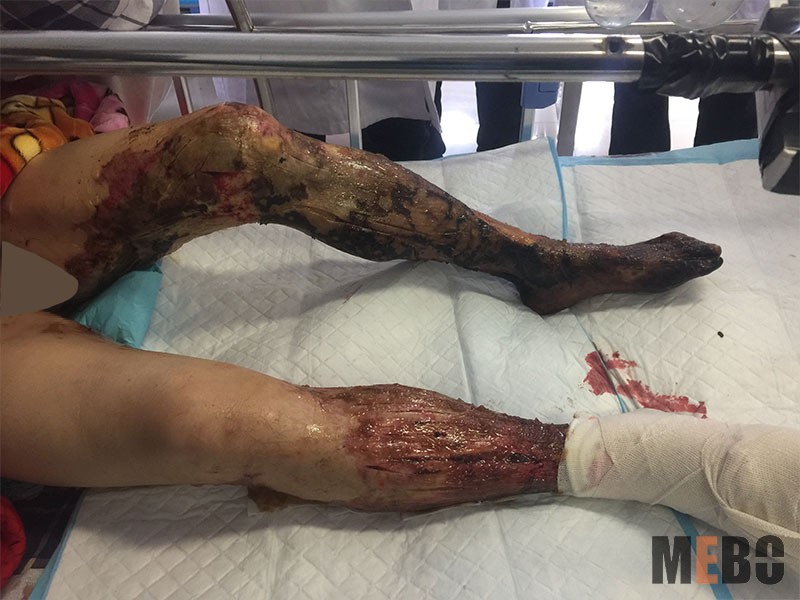 威客电竞(vkgame)-为竞技而生